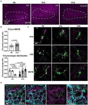 Loss of C1q alters the auditory brainstem response